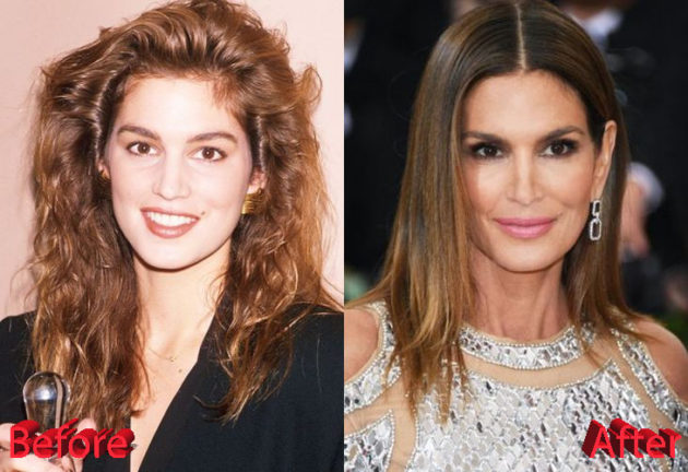 cindy crawford plastic surgery        
        <figure class=