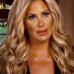 Kim Zolciak After Cosmetic Surgery