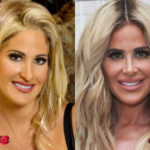 Kim Zolciak Before and After Plastic Surgery