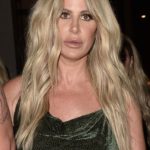 Kim Zolciak Plastic Surgery Controversy