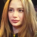 Arci Munoz After Plastic Surgery