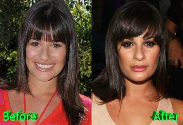 Lea Michele Nose Job Rumors And Allegations About It 