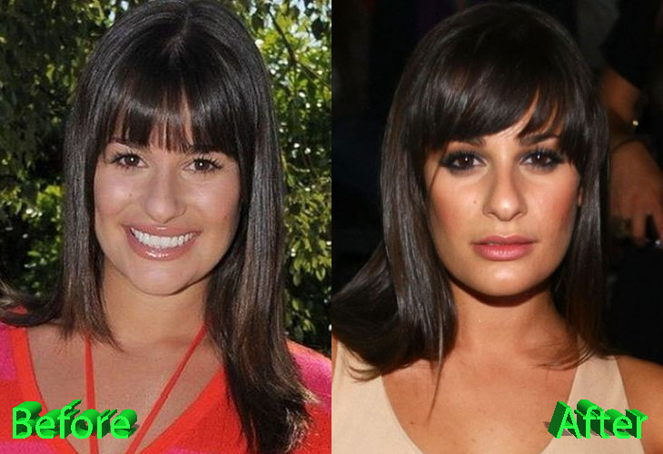 Lea Michele Before and After Nose Job Surgery
