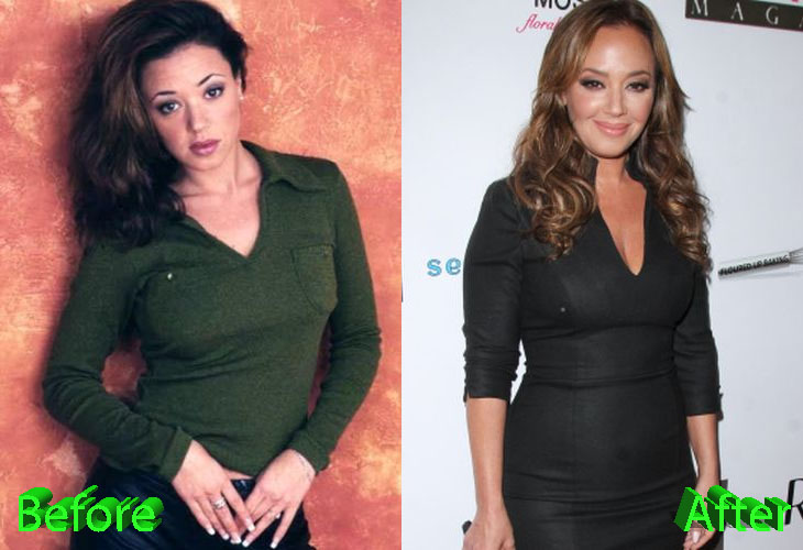 Leah Remini Before and After Cosmetic Surgery.