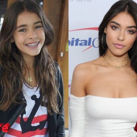 Madison Beer Plastic Surgery: Just Photoshop or the Real Thing?