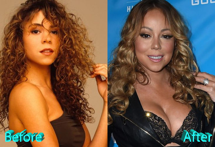 Mariah Carey Before and After Boob Job Surgery