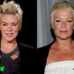 Mia Michaels Before and After Cosmetic Surgery