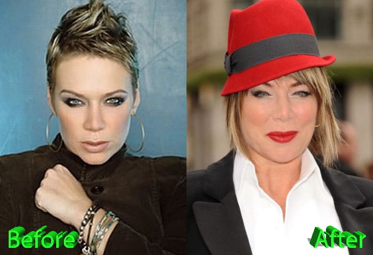 Mia Michaels Before and After Plastic Surgery