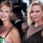 Charlize Theron Before and After Cosmetic Surgery