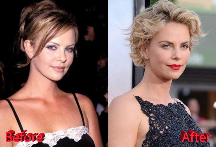 Charlize Theron Before and After Plastic Surgery