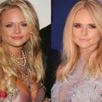 Miranda Lambert Before and After Cosmetic Surgery