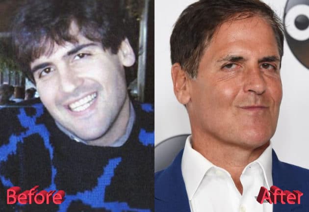 Mark Cuban Plastic Surgery: Is It A Flip Or A Flop?