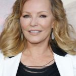 Cheryl Ladd After Cosmetic Surgery