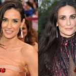 Demi Moore Before and After Plastic Surgery