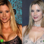 Mira Sorvino Before and After Cosmetic Surgery