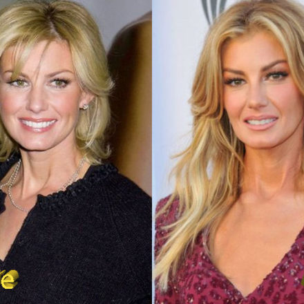 Faith Hill Plastic Surgery: Country Star Beautiful Look