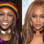 Tyra Banks Before and After Nose Job Surgery