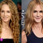 Holly Hunter Before and After Plastic Surgery