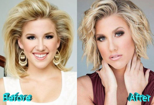 Savannah Chrisley Plastic Surgery Rumors Can Be True