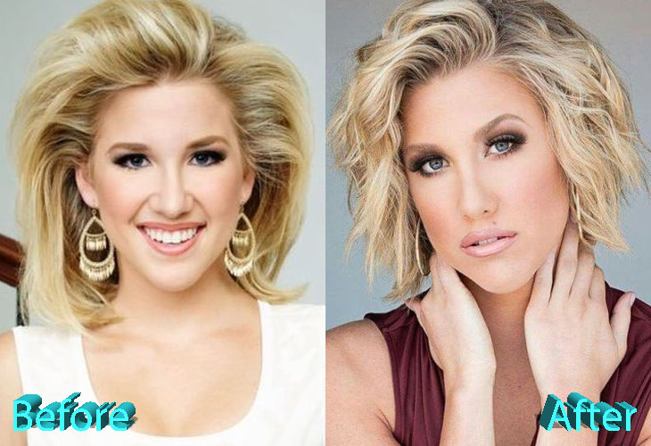 Savannah Chrisley Plastic Surgery Rumors Can Be True