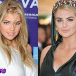 Kate Upton Before and After Cosmetic Surgery